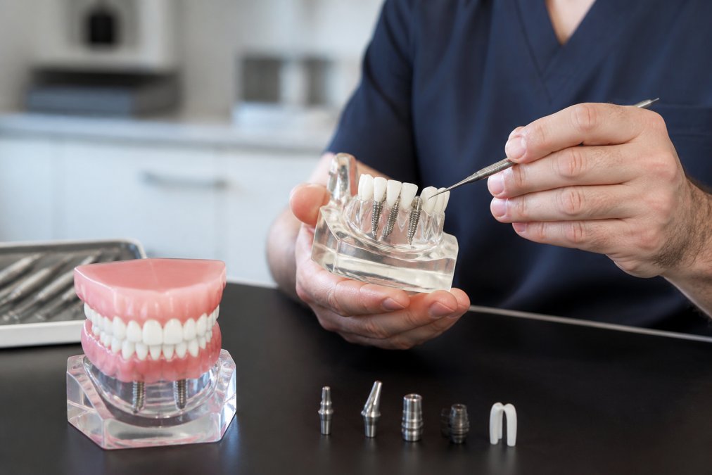 Modern Dental Technology for Implants: What to Know
