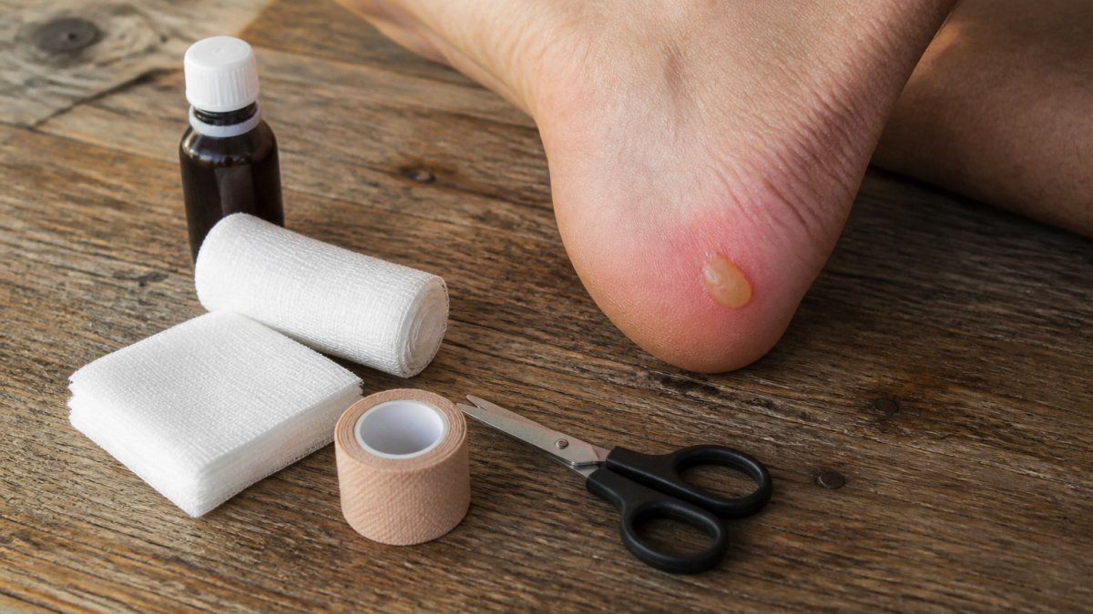 Close-up of a runner's foot showing a blister on the heel with clean supplies nearby including sterile gauze, antiseptic solution, and protective bandaging materials on a clean surface