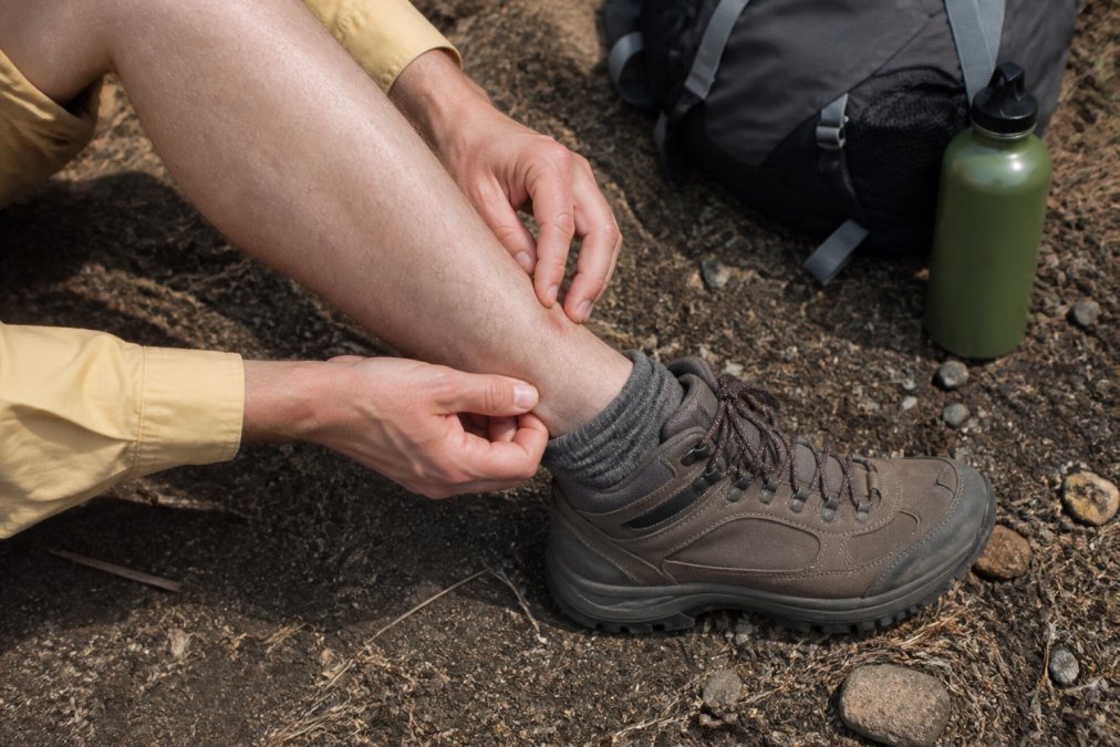 Close-up of hands performing a systematic tick check on lower leg and ankle area, examining skin carefully after outdoor hiking in natural daylight