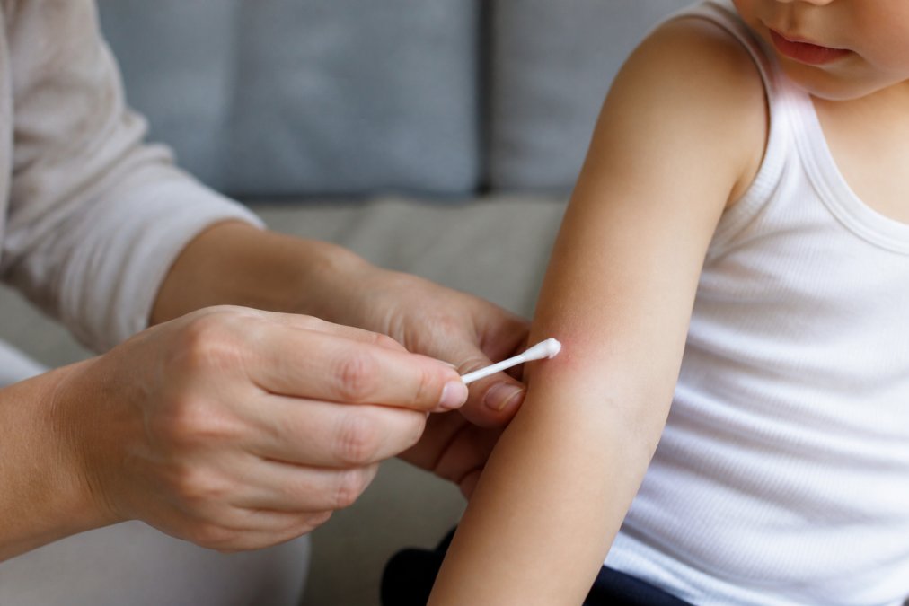 Close-up of a parent gently applying Clear Skin cream to a child's arm with a clean applicator, showing tender care and proper application technique