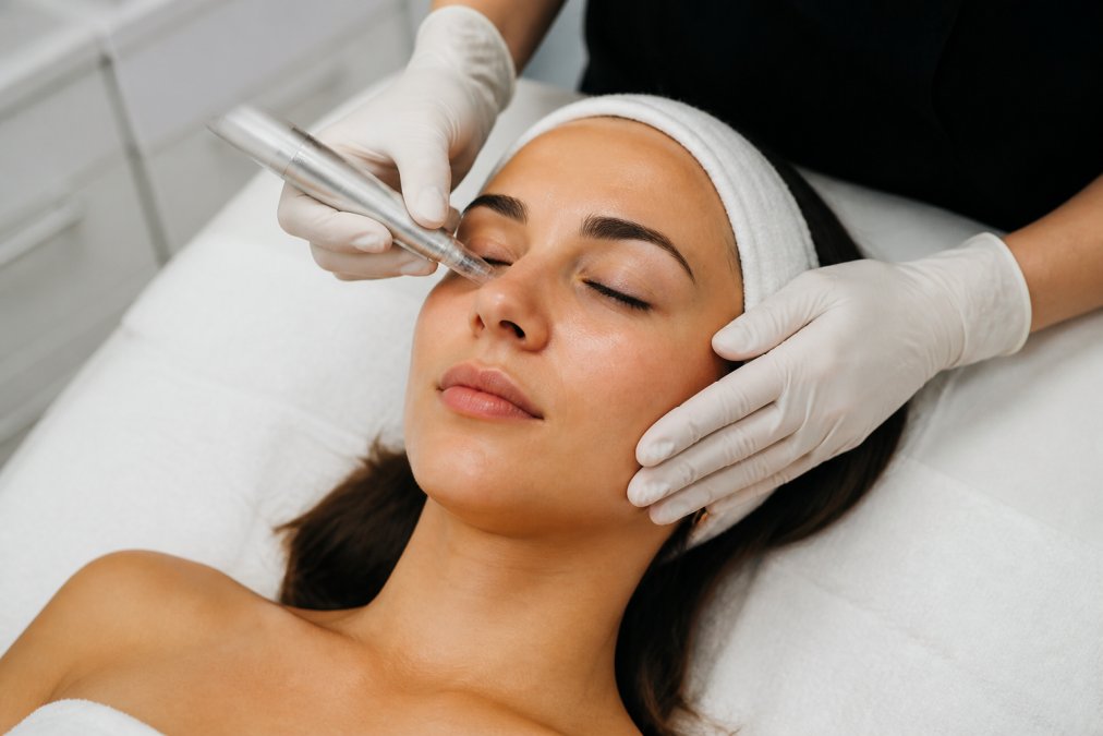 Non-Surgical Acne Scar Treatment Options: A 2026 Guide
