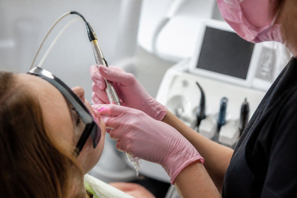 Close-up of modern dental laser equipment in use during procedure, showing precision tip and clinical setting with advanced technology, dentist's hands visible with steady control