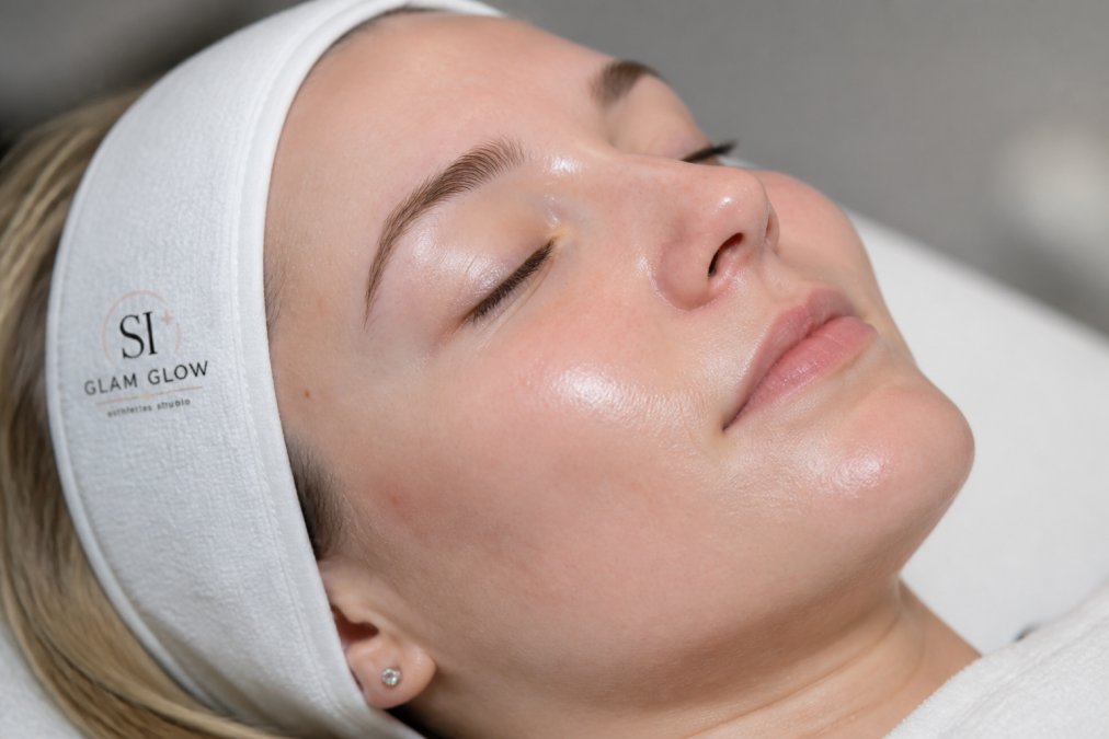 Professional illustration showing professional acne treatment cost