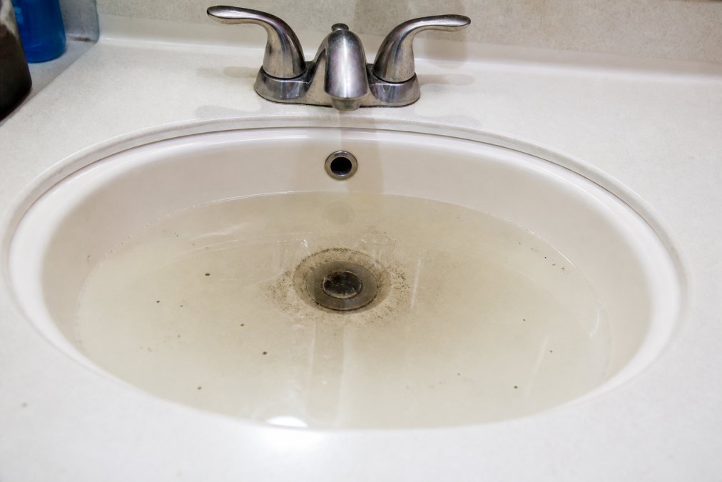 Close-up of a slow-draining bathroom sink with standing water and visible grime buildup around the drain opening, under bright bathroom lighting