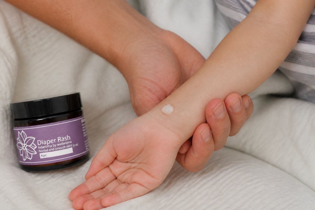 Close-up of child's inner wrist showing a small dab of diluted essential oil cream applied to skin for patch testing, with parent's hand gently holding the wrist