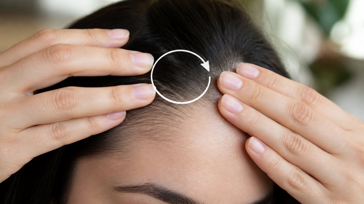 Diagram demonstrating fingertip circular motions on the hairline to stimulate the scalp for hair growth