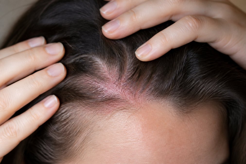 Step-by-step visual guide for sensitive scalp