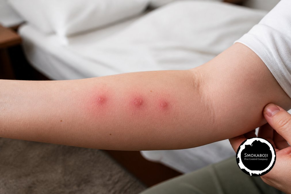 Person's arm showing three to five clustered red welts and bite marks arranged in a line pattern, with visible skin inflammation and swelling