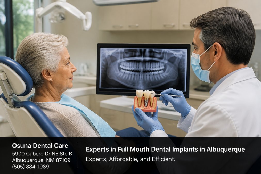 Signs You Need a Bone Graft for Implants