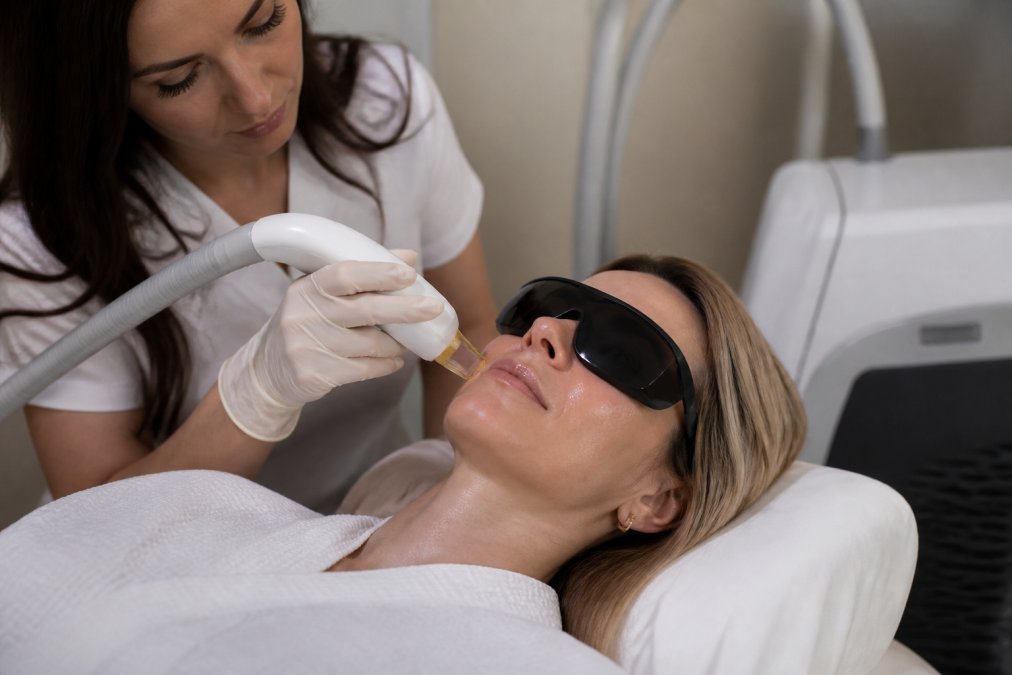 Skinsation Alternatives: Top Laser Skin Rejuvenation Options