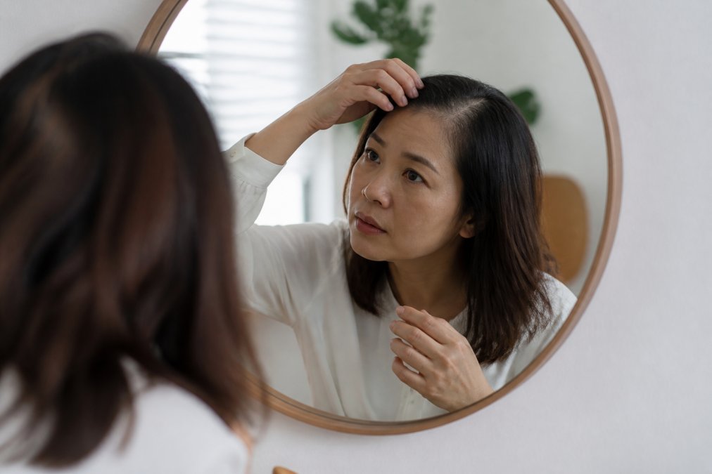 TCM Approach for Female Alopecia: A 2026 Guide