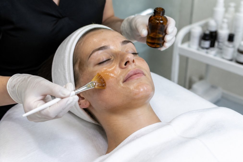 Hands applying amber-colored chemical peel solution to clean facial skin with a soft brush applicator, demonstrating even coverage technique under bright clinical lighting