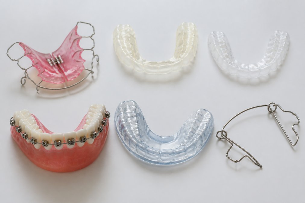 Verschiedene Arten von Zahnschienen und Retainern (fest und lose, durchsichtige Aligner und feste Brackets) nebeneinander auf einer weissen Oberfläche, professionell beleuchtet