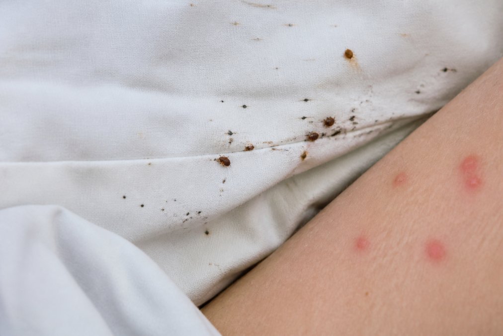 Close-up of bed bug infestation signs on white cotton bedding including small dark insects clustered in seams, rust-colored stains from fecal matter, and bite marks visible on exposed skin