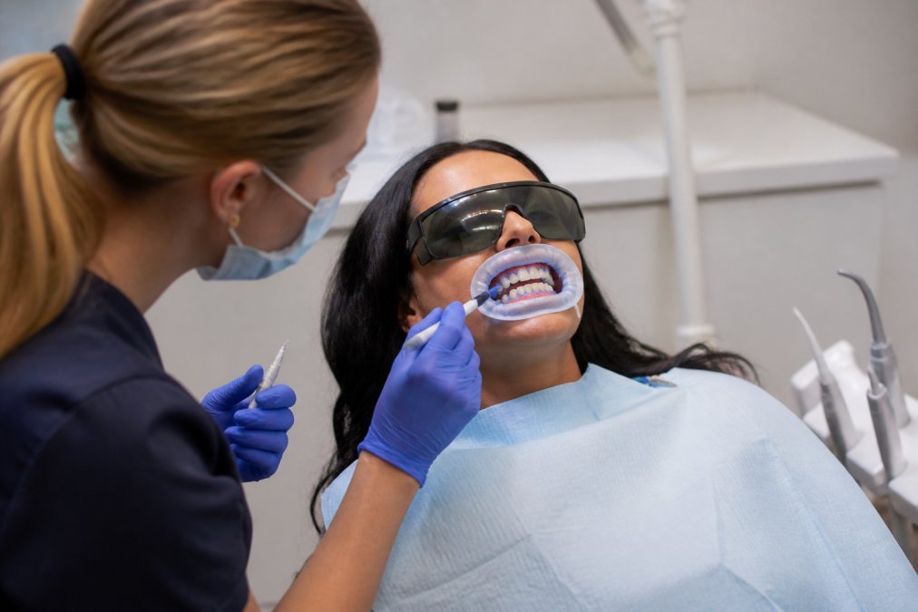 Patient seated in dental chair receiving professional whitening treatment with protective barriers in place and whitening gel applied to teeth, modern clinical lighting