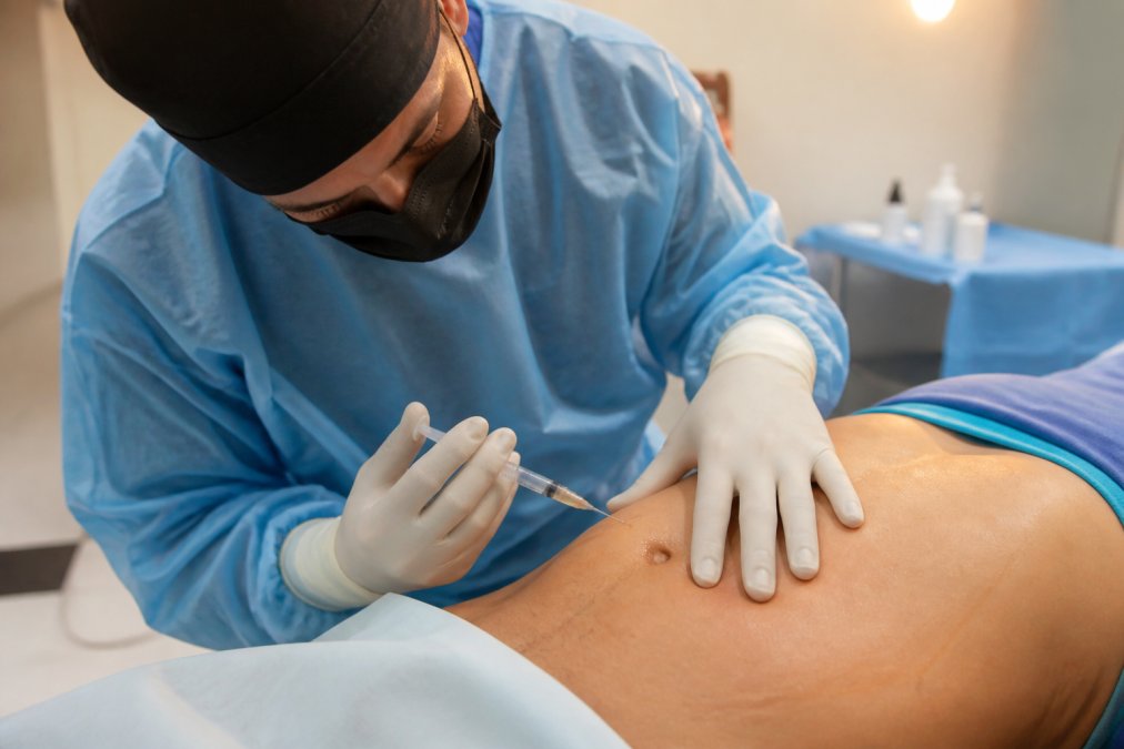 Surgeon carefully administering local anesthesia injection to patient's abdomen in modern surgical suite with warm lighting and sterile environment