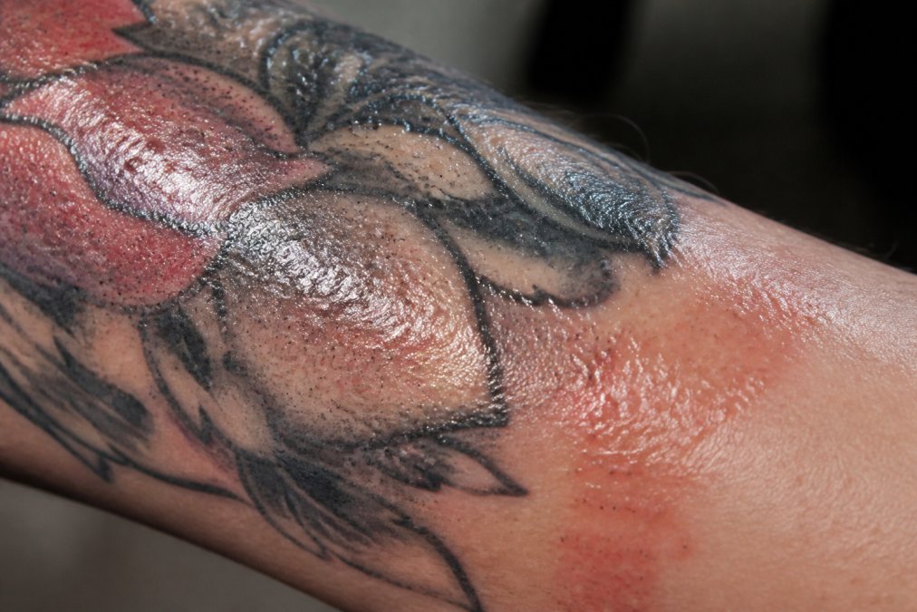 Close-up of a fresh tattoo on a forearm showing shiny, overly moisturized skin with visible clogged pores and slight redness around the edges