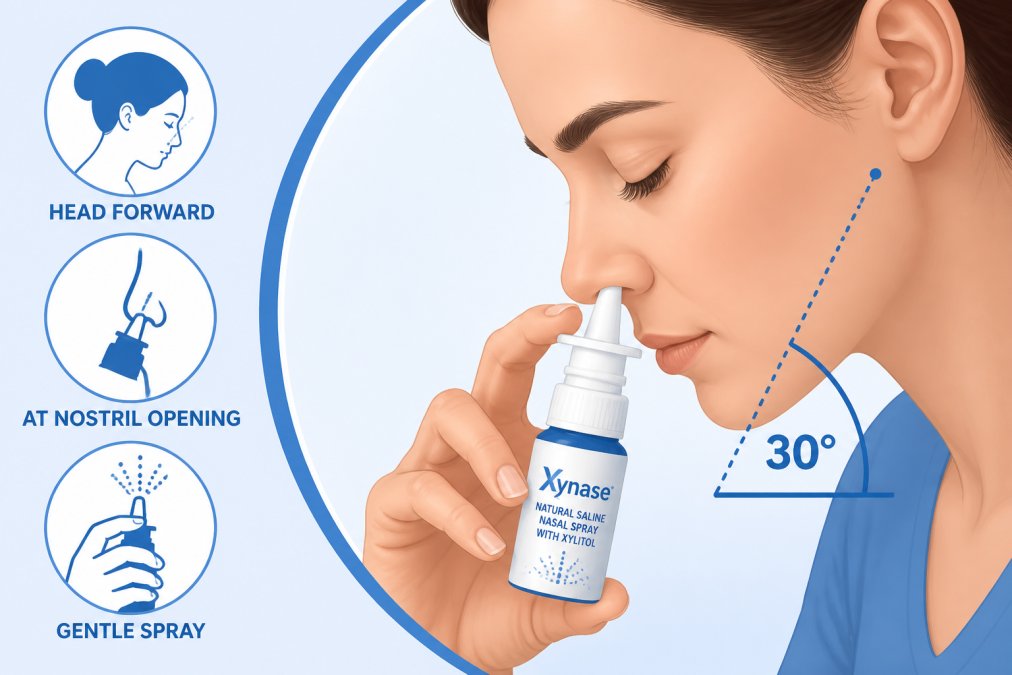 Close-up of person demonstrating proper nasal spray technique with head tilted forward at correct angle, showing spray bottle positioned at nostril opening with good lighting